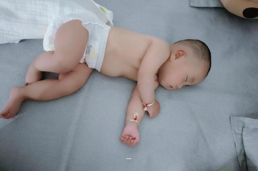 广饶宝宝脸上有白色斑块